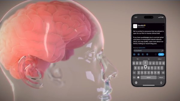 Neuralink Achieves a Milestone with First Human Brain Implant